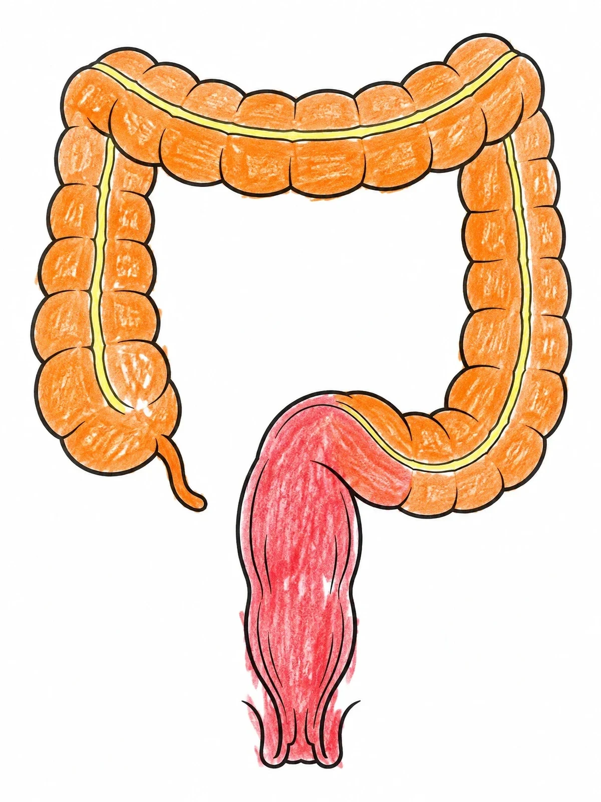 Colored example of the Large Intestine And Rectum Anatomy coloring page